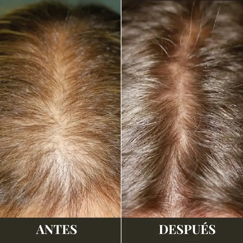 Aceite de Romero – El Secreto Para Volver a Sentirte Vos