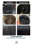 Shampoo Brimless Botánico – Canas Fuera en Segundos