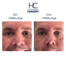 Instant FIRMx – Rejuvenece en 90 Segundos 